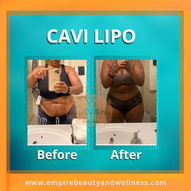 Empire Beauty And Wellness